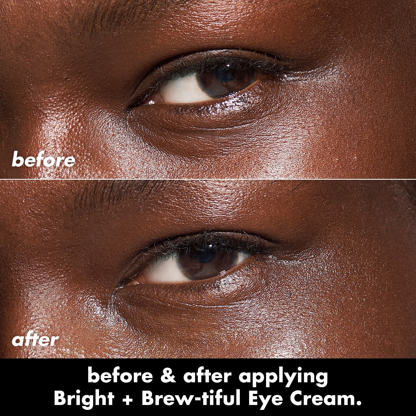 bright-brew-tiful-eye-cream-v4 0226_BBEC_Eye_BA_Diptych_607e3ec2-f0e1-4365-9b28-17574d841250.jpg