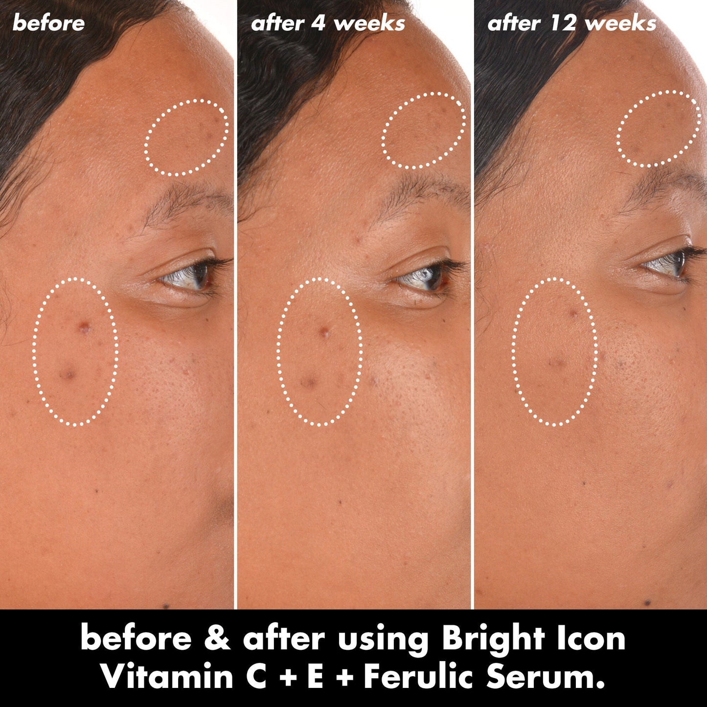 bright-icon-vitamin-c-e-ferulic-serum-g2 0226_EDU_BrightIconVitC_BA_Chanel_TRIPTYCH_c58f2fc8-209d-414f-9ba3-666a07a94887.jpg