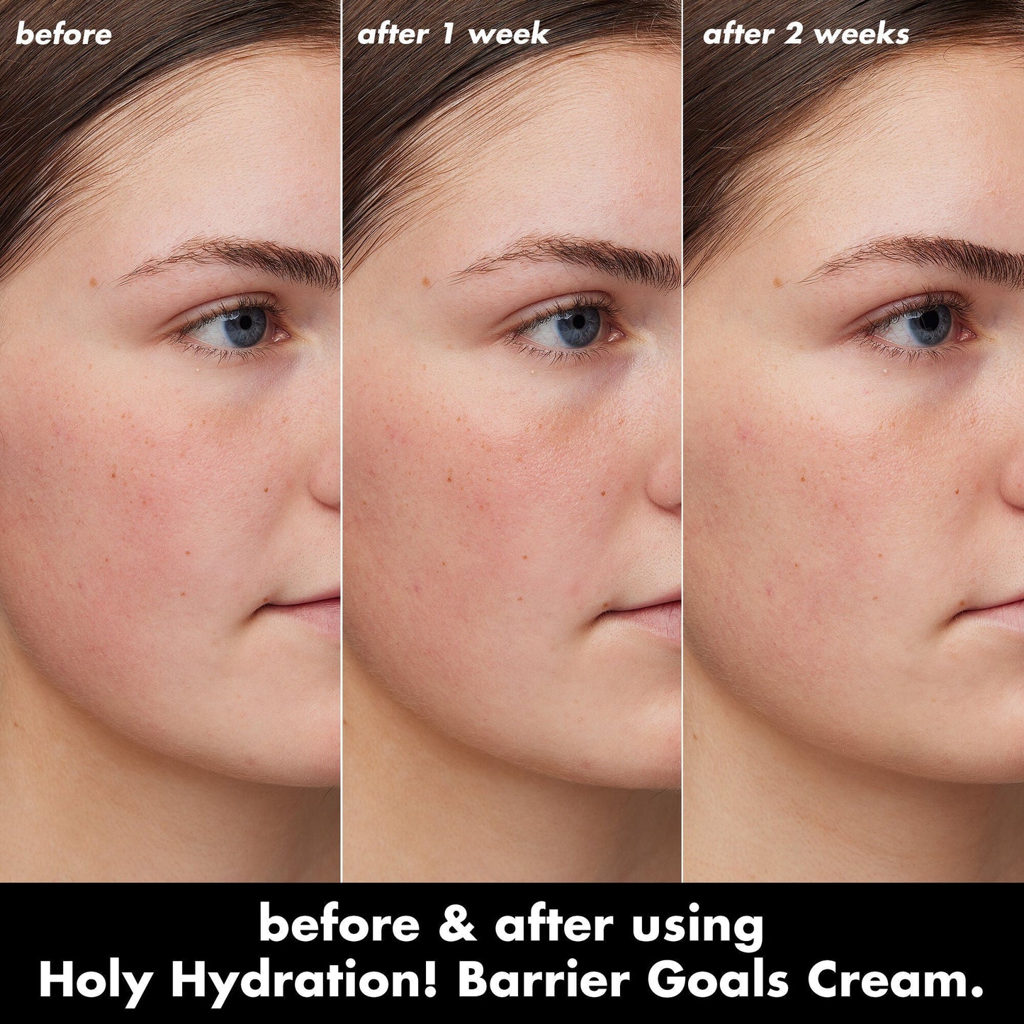 holy-hydration-barrier-goals-cream-mini-f3 0226_EDU_HHBarrierGoalsCream_B_A_Zoe_TRYPTICH_4f0e5b5d-35fb-4020-968e-244d4536afbd.jpg