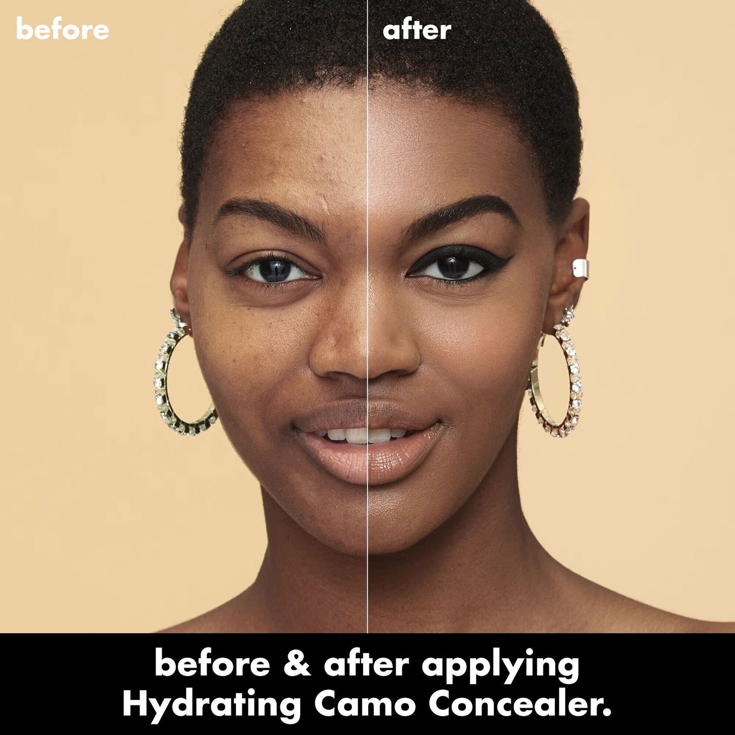 hydrating-camo-concealer-h7 0226_EDU_HydratingCamoConcelaer_BA_AshleyKaresh_20_1_d8499bbf-0e91-4173-b5e2-75127caf83a3.jpg