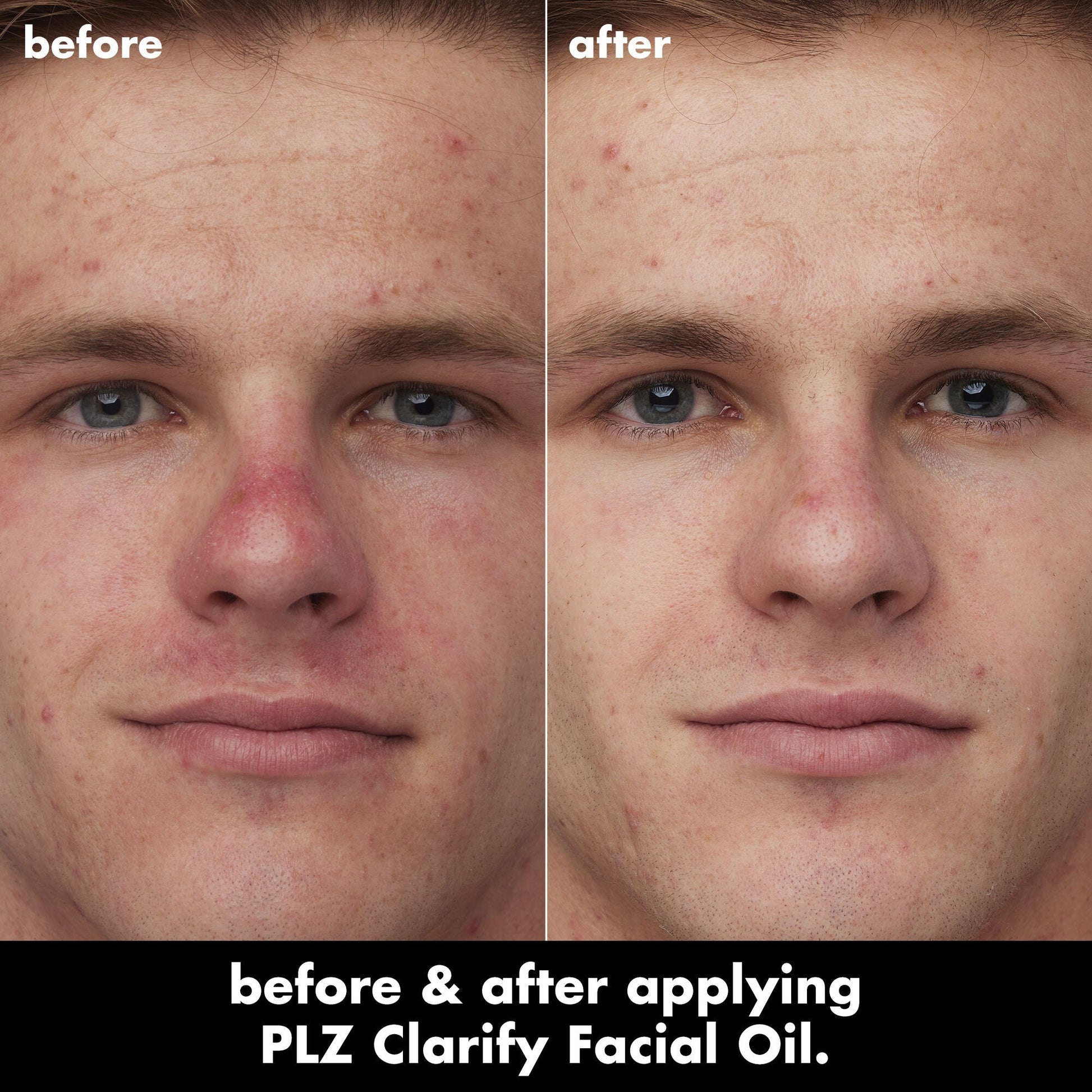 plz-clarify-facial-oil-l2 0326_EDU_PlzClarify_BA_Caleb.jpg