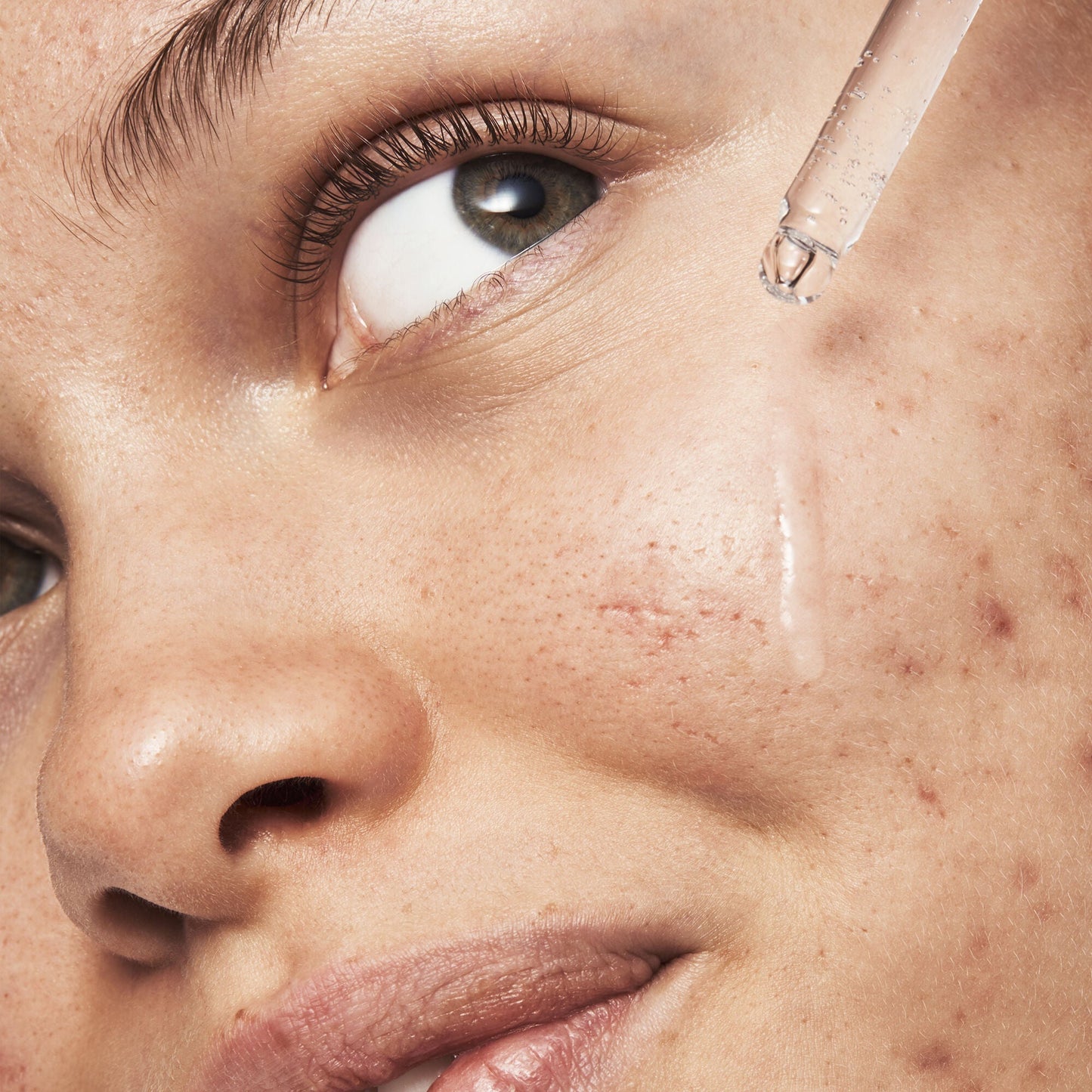 blemish-breakthrough-triple-acid-resurfacing-serum-e1 121321_Marley-Acne-Regimen_0254_FINAL_IGF.jpg